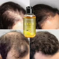 Unisex Anti Hair Loss Ginger Shampoo Hair Growth Products Shampoo Against Hair Loss Mild Treatment Ginger Shampoo