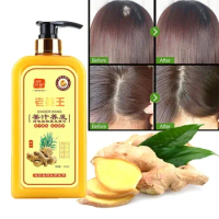 Hair regeneration shampoo ginger Shampoo Hair regrowth Dense Fast Thicker Shampoo Anti-hair loss Product Hair care styling 500ml
