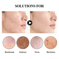 Sdottor Face Deep Cleansing Mask Stick Moisturizing Shrink Pore remove acne Blackhead Solid Masks Facial Film Korean Skin Care P