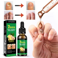 7 Days Nail Fungal Treatment Essence Oil Foot Toe Nail Fungus Removal Serum Repair Onychomycosi Anti Infection Gel Care Products