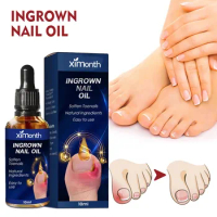 10ml Nail Treatment Fluid Anti Infection Fungal Treatment Fluid Bactericidal Onychomycosis Essence Multipurpose for Foot Care