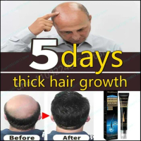Sdottor Hair Growth Spray Strengthening-Hair Massage Scalp Dense-Hair Strengthening Hair Loss Prevention Repair Nourishing Liqui