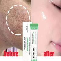 Salicylic Acid Replenishing And Repairing Gel Pore Shrinking Cream Elimination Large Pores Remove Blacke Head Tighten Face Care