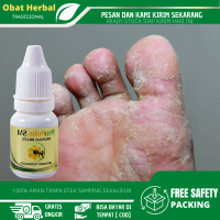 Propolis SM Cairan Oles Kutu Air Pada Kaki, Kuman Air Ruam dan Gatal, Penghilang Kutu Air, Gatal Kak