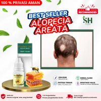 Propolis SM Untuk alopecia areata, penumbuh rambut pitak, botak koin, Perawatan rambut rontok dan Ru