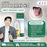 Obat Radang Lidah,Infeksi Lidah,Lidah Putih Bau ,Benjolan Lidah Dengan Propolis Sm Tetes Herbal Ant