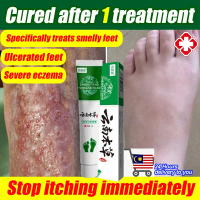 Stop itching immediately ubat gatal kulit paling berkesan Eczema Cream20g Original ubat kulat air ka