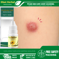 Salep Bisul Biar Gak Tumbuh Lagi, Bisul Untuk Anak, Bisul Di Pantat, Bisuk Di Ketiak, Bisul Di Kemal