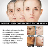 Sdotter New Whitening Face Serum Fade Dark Spot Freckle Remove Pigment Melanin Brighten Improve Rough Dull Skin Moisturizing Fac