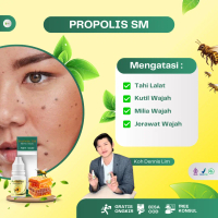 Propolis SM Cairan Perawatan Kutil dan Tahi Lalat Penghilang Kutil Di Wajah Leher Badan Area Tubuh U
