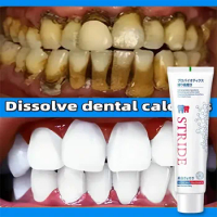 Dental Calculus Remover Toothpaste Whitening Brightening Teeth Preventing Periodontitis Fresh Breath Professional Teeth Care