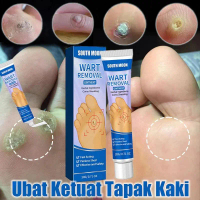 【Hot selling】Ubat Ketuat Tapak Kaki Ubat Mata Ikan Penampal Ketuat Remover Foot Corn Remover Wart Re