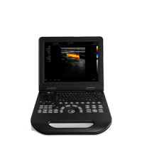 15.6 Inch Screen CE Certificate Portable 3D Color Doppler Ultrasound Scanner Vascular Doppler Machine E30 Notebook Ultrasonic