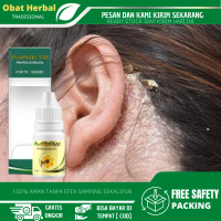 Propolis SM O b a t Tetes Ketombe Parah Menahun, Ketombe Berkerak, Ketombe Bersisik, Kulit Kepala Ga