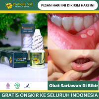 Solusi Penyembuhan Sariawan di Bibir, Bibir Sakit Dan Gatal, Bibir Bengkak, Bibir Kering, Bibir Luka