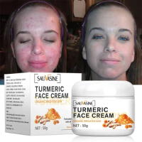 Turmeric Cream To Repair Acne Dark Spots, Facial Moisturizing, Whitening and Anti-acne Care
