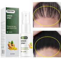 hair growth for men Ginger Hair Growth Spray Prevent Hair Loss Product Baldness Restore Scalp Treatment Germinal Hair