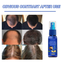 Ginger Hair Grower Spray Anti Hair Fall Hair Loss Hair Growth Oil For Men Women Hair Loss Product Series