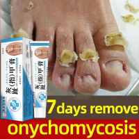 Obat Kuku Obat Jamur Kuku Perawatan Jamur Kuku Rusak Berjamur Nail Care Anti Jamur Perawatan Kuku ob