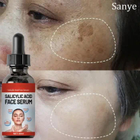 Niacinamide Whitening Serum Face Freckles Cream Dark Spot Remover Salicylic Acid Pore Shrink Essence Moisturize Korean Skin Care