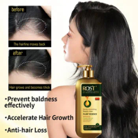 Herbal Anti-dandruff Shampoo Anti Hair Loss Scalp Repair Damage Care for Men and Women