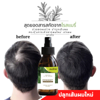 ลดผมร่วงผู้ชาย สเปรย์โรสแมรี่ ปลูกผม hair serum hair fall ลดผมร่วง ผมยาว โควิดผมร่วง hair tonic คําแ