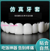 牙套吃飯神器 成人老人缺牙牙縫歪牙臨時遮醜通用矽膠套 仿真牙齒