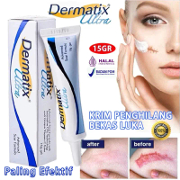 PROMO ASLI ORIGINAL100% Dermatix Ultra Advanced Scar Gel 15g Penghilang Bekas Luka Jerawat Stretch M