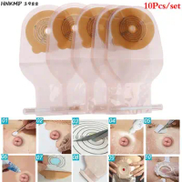 10Pcs Colostomy Bags 15-65mm Stoma Pouch Bags One-piece Open Ostomy Bags Skin Color No Need Clip Translucent Colostomy Bag