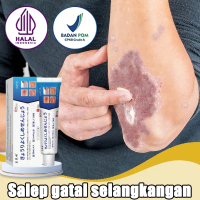 Salep gatal Salep Eksim Salep kulit Krim psoriasis paling ampuh 20g Kulit Kepala Psoriasis Tangan Ti