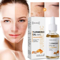Turmeric Freckle Whitening Serum Curcumin Oil Face Brighten Moisturizing Fade Dark Spot Removal Pigment Melaninskin Care Product