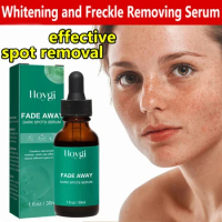 Dark Spot Remover For Face Sun Melasma Freckles Pigment Age Spots Removal Freckle Whitening Serum