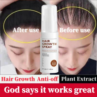 Hair grower Spray hair Growth essence Spray essential oil anti Hair Loss Treatment For Men and women