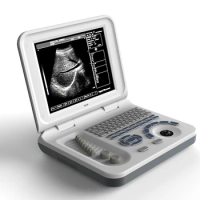 Custom logo Ultrasound Scanner notebook machine hospital Diagnostic System S50A medical portable