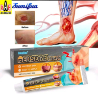 obat cina luka basah luka diabetes sumifun bedsore membantu memperbaiki sel kulit mati pada luka bas