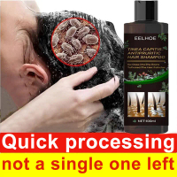 Shampoo kelemumur Scalp treatment Shampoo anti dandruff Ubat kulit kepala berkuping Psoriasis Itchy 