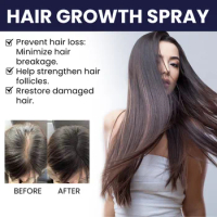 Hair Growth Products Hair Growth Spray Moisturize Scalp Hair Damage Strengthen Hair Growth Hair Essential Oils для волос