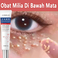 BPOM Krim Penghilang Milia Paling Ampuh Eye Cream Milia Remover Obat Milia Di Bawah Mata Krim Milia