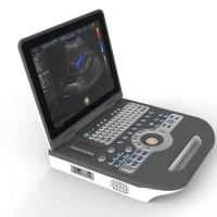 S3500 Notebook color Doppler 15-inch screen host 1024 * 768 high resolution Support for 7 foreign languages