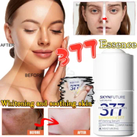 SKYNFUTURE 377 Whitening Essence Brightens Skin Tone Improves Dullness Moisturizes Spots Brightens Niacinamide Liquid 18ml