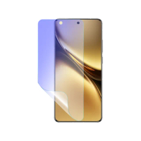 【o-one】vivo X200系列 護眼螢膜PRO 全新升級 抗藍光螢幕保護貼(輕微刮痕自動修復)
