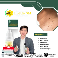 Propolis SM - Penghilang Tahi Lalat / Bintik Hitam Coklat di Wajah Leher Seperti Tahi Lalat / Kutil
