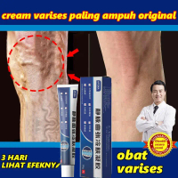 Obat varises Salep varises paling ampuh Varicose veins cream Krim Varises Di Kaki Dan Betis Menghila