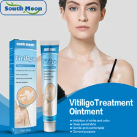 South Moon Spot care health ointment, vitiligo net ointment, spot sweat, vitiligo skin topical ointment
