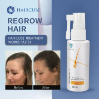 Powerful Hair Growth Serum Spray Loss Hair Growth Hair Anti Hair Loss Repair Nourish Hair Roots Regrowth For Men Women