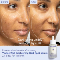 Whitening Serum Curcumin Oil Face Brighten Moisturizing Fade Dark Spot Removal Pigment Melaninskin Care Product Skin Care
