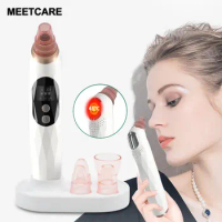 Vacuum Cleaner Blackhead Remover Heatable with Base Photon Rejuvenation Facial Cleaner Acne Pore Extractor Skin Tool