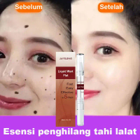 Penghilang Kutil Dan Tahi Lalat wart remover pembersih kutil salep penghilang kutil penghilang skin 