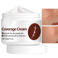 Anti Scar Cream 30g Effective Burn Scar Cream Protective Body Cream Portable Scar Gel Natural Scar Remover For Body Face Old
