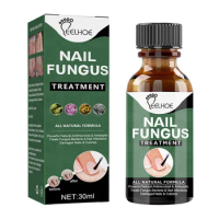 30ml/50ml Toenail Fungus Treatment Extra Strength Care Nail Repair Solution Feet Care Essence for Finger Toenail